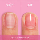essie Nagelversterker Hard To Resist Nail Strengthener, 13,5 ml