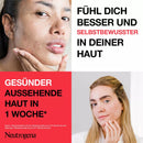 Neutrogena Wash Gel Anti-Puistjes+ Onzuivere Huid, AHA/ PHA / BHA, 200 ml