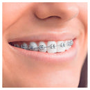 Oral-B Opzetborstels Ortho Care Essentials, 3 stuks