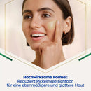 NIVEA Serum Cellular Luminous 630 Anti-Pigmentvlekken, 30 ml
