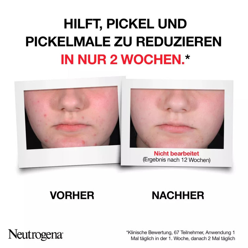 Neutrogena Serum Anti-Puistjes+ Onzuivere Huid, AHA/ PHA / BHA, 30 ml
